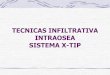 Tecnica Intraosea X Tip Para Video