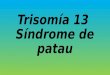 Trisomía 13  síndrome de patau