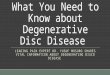Facts You Should  Know about Degenerative Disc Disease