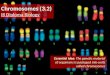 IB Biology 3.2 Slides: Chromosomes