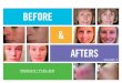 Rodan + Fields Before and After Photos