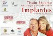 Folleto Curso Implantes en portugués