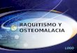 Raquitismo y osteomalacia