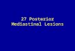 27 posterior mediastinal lesions