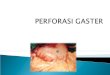 Powerpoint Perforasi Gaster