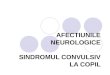 Curs 10 Af. Neurologice