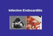 infektif endokarditis