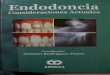 Endodoncia Consideraciones Atuales - Antonio Rodrigues-ponce