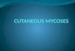 Cutaneous Mycoses