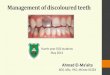 Management of Discoloured Teeth