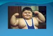 Obezitatea la copii si tratamentul medicamentos in pediatrie