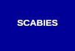Scabies New