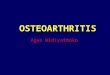 Osteoarthritis Fk Umy