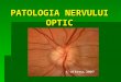 5 Patologia Nervului Optic