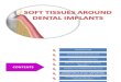 Soft Tissues Around Dental Implants