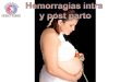 Hemorragias Intra y Post Parto