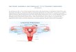 uterine fibroids Case Study