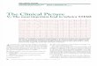 V1 - The Most Important Lead in Inferior STEMI
