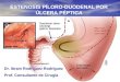 Estenosis Piloro Duodenal Por Ulcera