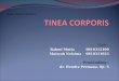 Case Report Session - Tinea Korporis - Copy (2)