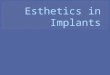 Esthetics in dental Implants