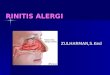 Ppt Rhinitis Alergi