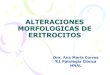 Alteraciones Morfologicas de Eritrocitos