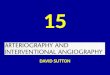 15 DAVID SUTTON PICTURES Arteriography and Intervewntional Radiology