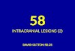 58 DAVID SUTTON PICTURES INTRACRANIAL LESIONS (2)