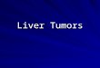 Liver tumors - A basic guide to diagnose and treat liver tumors