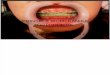 Prinsip dan biomekanika orthodonti