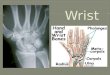3 wrist flexors  flexor carpi radialis  flexor carpi ulnaris  palmaris longus 3 wrist extensors  extensor carpi radialis longus  extensor carpi radialis
