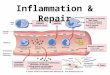 Inflammation & Repair. Inflammation Acute Inflammation Cardinal signs –Red (rubor) –Swelling (tumor) –Warm (calor) –Tender (dolor) –Loss of function