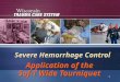 1 Severe Hemorrhage Control Application of the Sof-T Wide Tourniquet