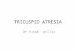 TRICUSPID ATRESIA Dr Vivek pillai. Defined as congenital absence or agenesis of the tricuspid valve, with no direct communication between the right atrium