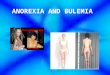 ANOREXIA AND BULEMIA. What is an eating disorder? An eating disorder is an obsession with food and weight that harms a person's well-being. Although we