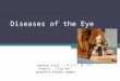 Diseases of the Eye Casey Conway Jeannie Stall, R.V.T. & ??? Credits : Clip Art graphics/Google images
