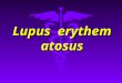 Lupus erythematosus. Definition Lupus erythematosus Lupus erythematosus LE is classified as connective tissue disease. It occurs predominantly in females