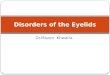 Dr.Mazen Khwaira Disorders of the Eyelids. Benign eyelid lesions Malignant eyelid tumours Disorders of eyelashes Entropion Ectropion Ptosis