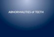 ABNORMALITIES of TEETH. Abnormalities of Teeth Environmental abnormalities of teeth Developmental abnormalities of teeth
