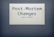 Post-Mortem Changes Time of Death. Post-Mortem Changes  Livor Mortis/ Hypostasis  Rigor Mortis  Algor Mortis/ Body Cooling  Decomposition  Five general