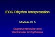 ECG Rhythm Interpretation Module IV b Supraventricular and Ventricular Arrhythmias