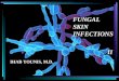 Selling a Product or Service FUNGAL SKIN INFECTIONS II IHAB YOUNIS, M.D