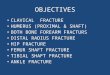 OBJECTIVES CLAVICAL FRACTURE HUMERUS (PROXIMAL & SHAFT) BOTH BONE FOREARM FRACTURS DISTAL RADIUS FRACTURE HIP FRACTURE FEMUR SHAFT FRACTURE TIBIAL SHAFT