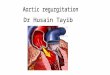 Etiology * Any conditions resulting in incompetent aortic leaflets * Any conditions resulting in incompetent aortic leaflets _ Congenital Bicuspid