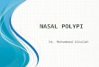 N ASAL POLYPI Dr. Mohammad Aloulah. Definition The term polyp derived from Latin word “Polypous” Many footed Defined as simple oedematous hypertrophic