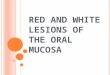 RED AND WHITE LESIONS OF THE ORAL MUCOSA. HEREDITARY WHITE LESIONS REACTIVE/INFLAMMATORY WHITE LESIONS INFECTIOUS WHITE LESIONS AND WHITE AND RED LESIONS