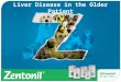 Liver Disease in the Older Patient. Agenda Liver Disease in the ageing patient Types Investigation Blood tests Others Treatment Antioxidants and Zentonil