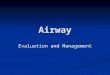 Airway Evaluation and Management. Indications of intubation Resuscitation (CPR) Resuscitation (CPR) Prevention of lung soiling Prevention of lung soiling