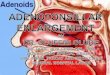 1. Common Diseases of the Tonsils and Adenoids Acute adenoiditis/tonsillitis Recurrent/chronic adenoiditis/tonsillitis Obstructive hyperplasia Malignancy